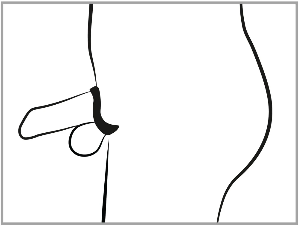 Cock Cage med Dilator - Image 6